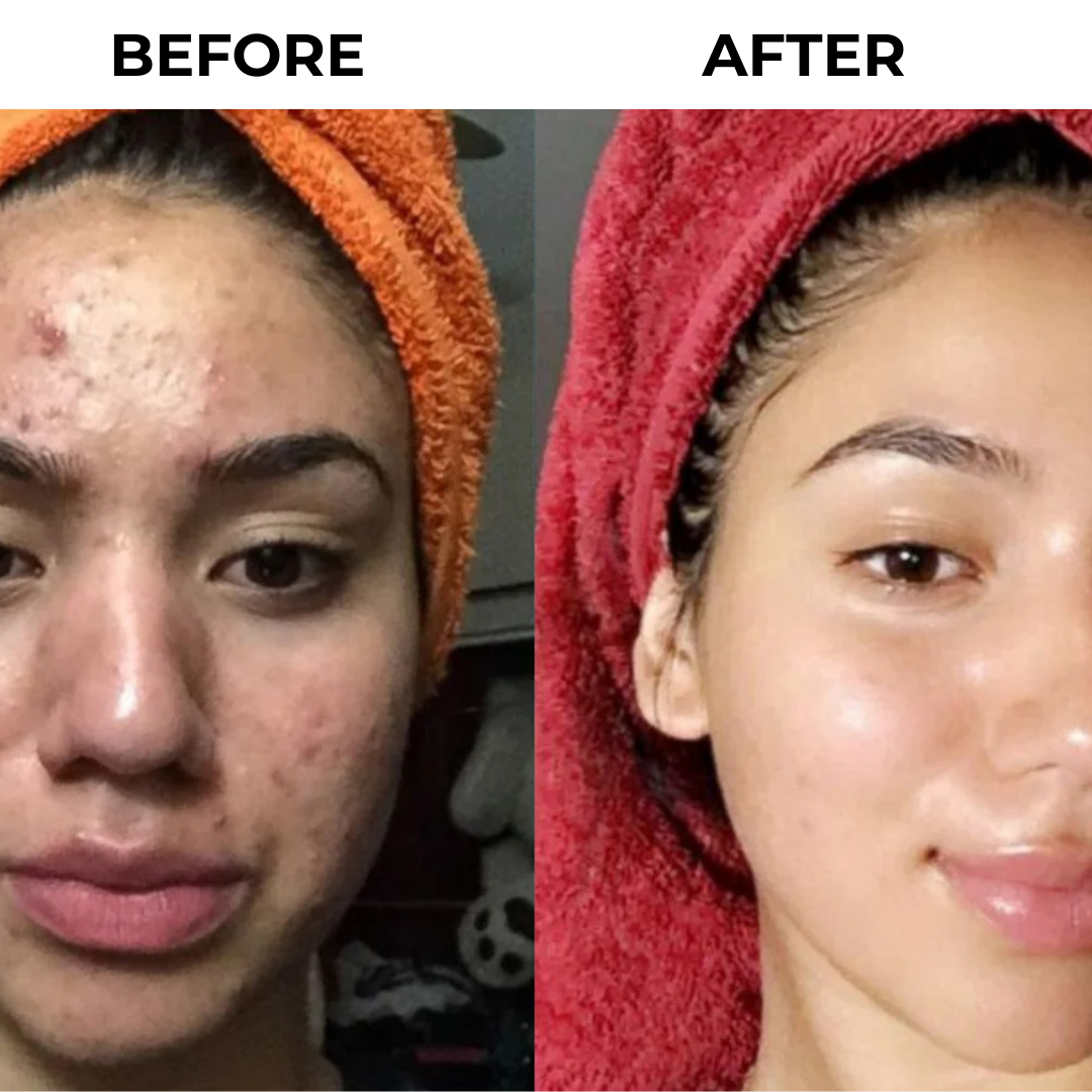 DermaSeal Pro